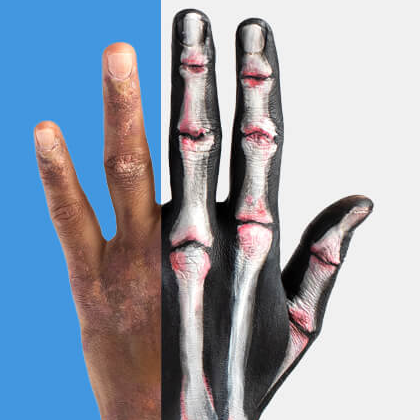 A hand, partially shown as an x-ray